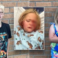 Un garçon de 8 ans du Michigan sauve sa sœur de 6 ans d'une attaque de chien presque mortelle